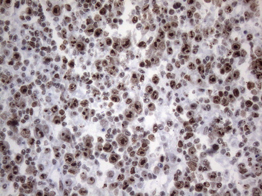 m09015 anti hnrnpa0 mouse monoclonal antibody clone id oti8h8 ihc testing 7