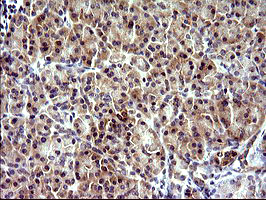 m09017 anti chac1 mouse monoclonal antibody clone id oti1e2 ihc testing 2