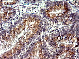 m09017 anti chac1 mouse monoclonal antibody clone id oti1e2 ihc testing 3