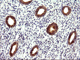 m09017 anti chac1 mouse monoclonal antibody clone id oti1e2 ihc testing 4