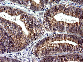 m09017 anti chac1 mouse monoclonal antibody clone id oti1e2 ihc testing 5