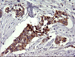 m09017 anti chac1 mouse monoclonal antibody clone id oti1e2 ihc testing 7