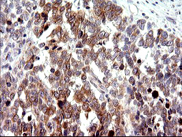 m09017 anti chac1 mouse monoclonal antibody clone id oti1e2 ihc testing 8