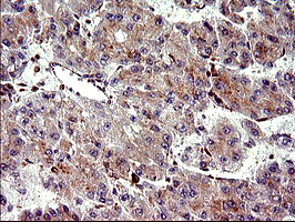 m09017 anti chac1 mouse monoclonal antibody clone id oti1e2 ihc testing 9