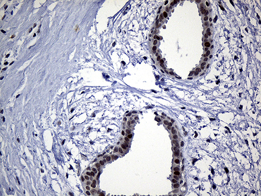 Immunohistochemical staining of paraffin-embedded Human breast tissue within the normal limits using anti-NEMF mouse monoclonal antibody