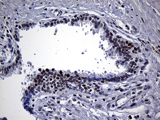 m09039 anti nemf mouse monoclonal antibody clone id oti7e10 ihc testing 4