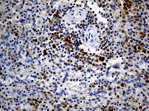 m09058 anti dapp1 mouse monoclonal antibody clone id oti7d4 ihc testing 5