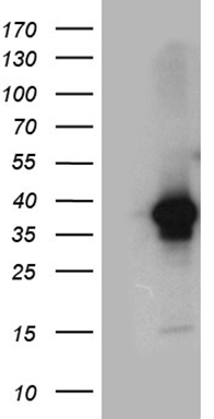 HEK293T cells were transfected with the pCMV6-ENTRY control (Left lane) or pCMV6-ENTRY DAPP1 (Right lane) cDNA for 48 hrs and lysed