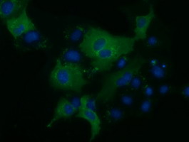 m09066 anti klhl2 mouse monoclonal antibody clone id oti1g7 if testing 4