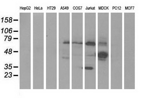 m09066 anti klhl2 mouse monoclonal antibody clone id oti1g7 wb testing 2