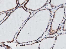 m09074 anti ogfod1 mouse monoclonal antibody clone id oti1f4 ihc testing 2