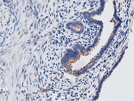 m09074 anti ogfod1 mouse monoclonal antibody clone id oti1f4 ihc testing 3