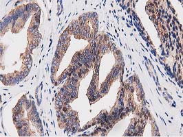 m09074 anti ogfod1 mouse monoclonal antibody clone id oti1f4 ihc testing 5