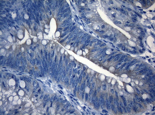 m09085 anti rab3ip mouse monoclonal antibody clone id oti5f2 ihc testing 2