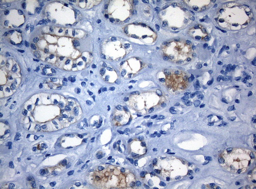 m09085 anti rab3ip mouse monoclonal antibody clone id oti5f2 ihc testing 4