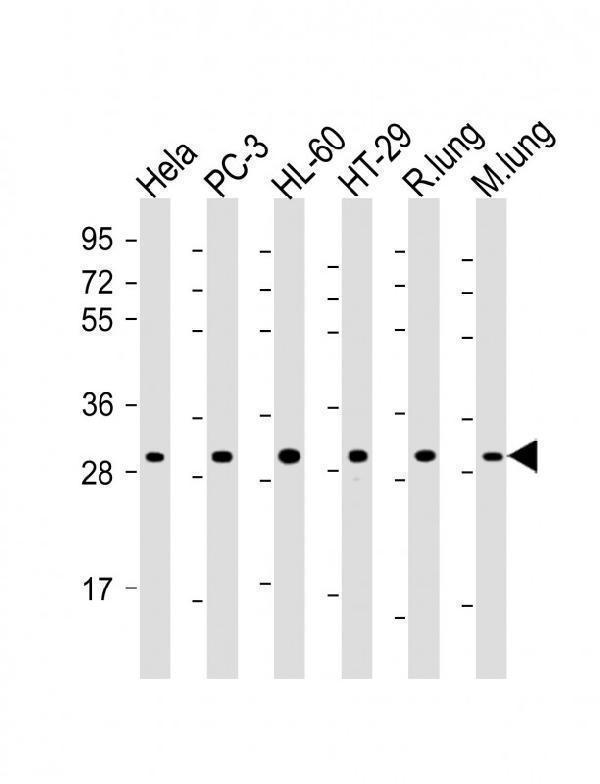 All lanes : Anti-RPS4X Antibody (C-Term) at 1:2000 dilutionLane 1: Hela whole cell lysateLane 2: PC-3 whole cell lysateLane 3: HL-60 whole cell lysateLane 4: HT-29 whole cell lysateLane 5: rat lung lysateLane 6: mouse lung lysateLysates/proteins at 20 µg per lane