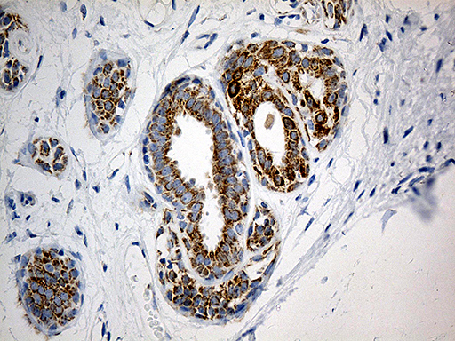 Immunohistochemical staining of paraffin-embedded Human breast tissue within the normal limits using anti-MTX2 mouse monoclonal antibody