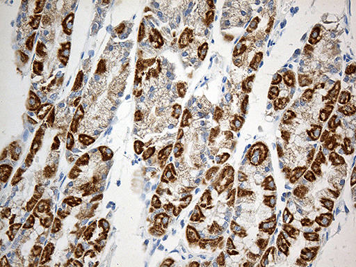 m09105 anti mtx2 mouse monoclonal antibody clone id oti2e9 ihc testing 4