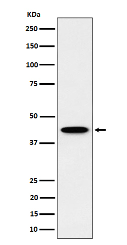 Western blot analysis of ITPK1 expression in HepG2 cell lysate