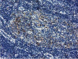 m09113 anti lin7 lin7b mouse monoclonal antibody clone id oti1c9 ihc testing 4