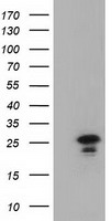 HEK293T cells were transfected with the pCMV6-ENTRY control (Left lane) or pCMV6-ENTRY LIN7B (Right lane) cDNA for 48 hrs and lysed