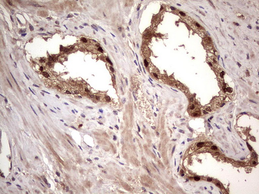 m09124 anti bfsp2 mouse monoclonal antibody clone id oti4e7 ihc testing 10