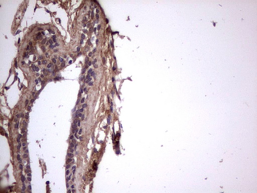 m09124 anti bfsp2 mouse monoclonal antibody clone id oti4e7 ihc testing 11