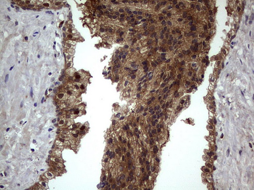 m09124 anti bfsp2 mouse monoclonal antibody clone id oti4e7 ihc testing 12