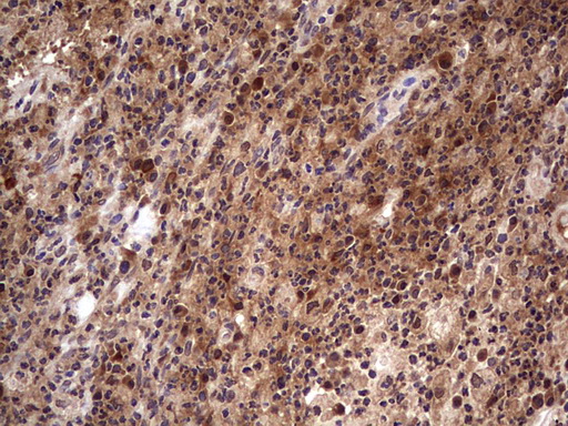 m09124 anti bfsp2 mouse monoclonal antibody clone id oti4e7 ihc testing 13