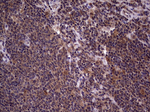 m09124 anti bfsp2 mouse monoclonal antibody clone id oti4e7 ihc testing 14