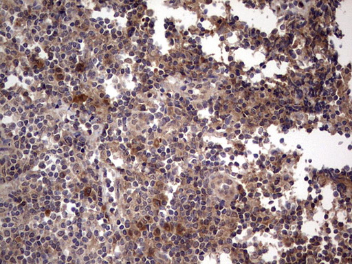 m09124 anti bfsp2 mouse monoclonal antibody clone id oti4e7 ihc testing 15