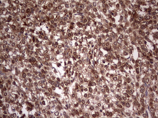 m09124 anti bfsp2 mouse monoclonal antibody clone id oti4e7 ihc testing 16