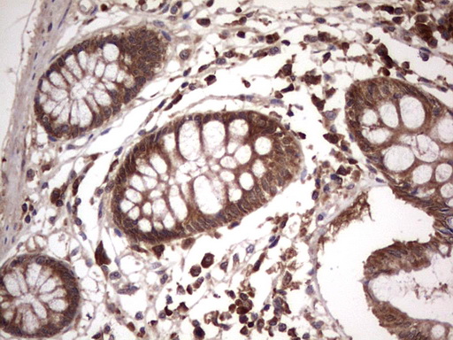 m09124 anti bfsp2 mouse monoclonal antibody clone id oti4e7 ihc testing 17