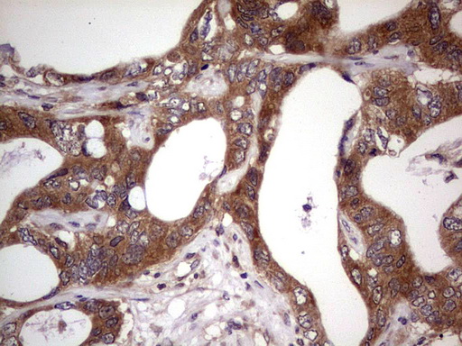 m09124 anti bfsp2 mouse monoclonal antibody clone id oti4e7 ihc testing 18