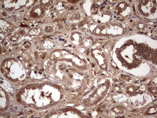 m09124 anti bfsp2 mouse monoclonal antibody clone id oti4e7 ihc testing 19