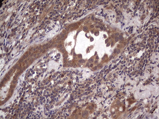 m09124 anti bfsp2 mouse monoclonal antibody clone id oti4e7 ihc testing 2