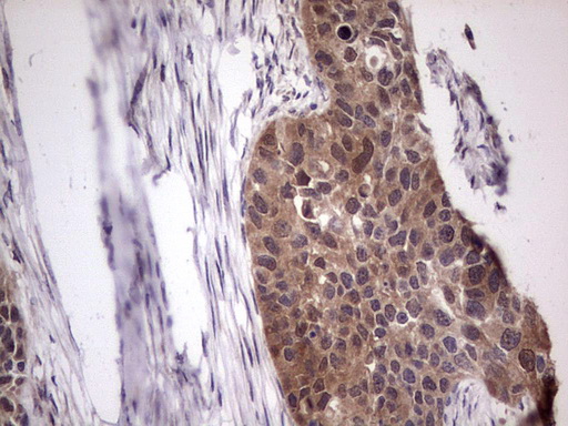 m09124 anti bfsp2 mouse monoclonal antibody clone id oti4e7 ihc testing 20