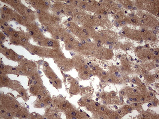 m09124 anti bfsp2 mouse monoclonal antibody clone id oti4e7 ihc testing 21