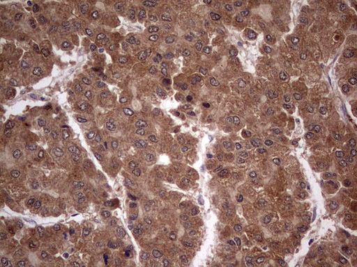 m09124 anti bfsp2 mouse monoclonal antibody clone id oti4e7 ihc testing 22