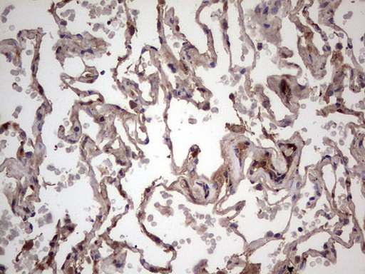 m09124 anti bfsp2 mouse monoclonal antibody clone id oti4e7 ihc testing 23
