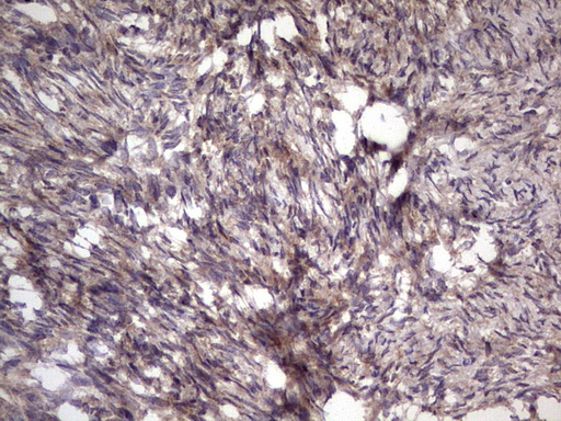 m09124 anti bfsp2 mouse monoclonal antibody clone id oti4e7 ihc testing 3
