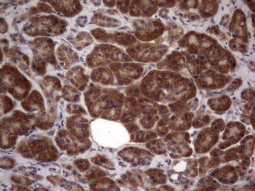 m09124 anti bfsp2 mouse monoclonal antibody clone id oti4e7 ihc testing 5