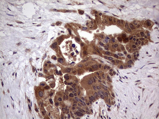 m09124 anti bfsp2 mouse monoclonal antibody clone id oti4e7 ihc testing 6