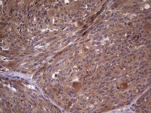 m09124 anti bfsp2 mouse monoclonal antibody clone id oti4e7 ihc testing 7