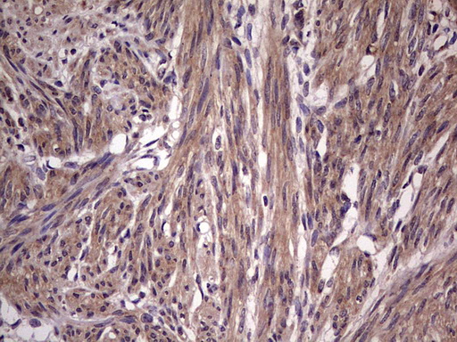 m09124 anti bfsp2 mouse monoclonal antibody clone id oti4e7 ihc testing 8