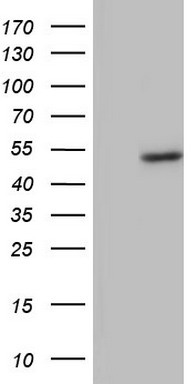 m09124 anti bfsp2 mouse monoclonal antibody clone id oti4e7 wb testing 1