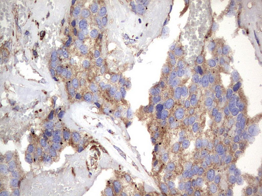 m09144 anti nrbf2 mouse monoclonal antibody clone id oti1a2 ihc testing 15