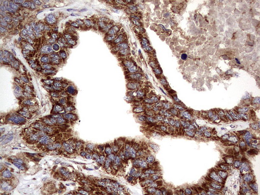 m09144 anti nrbf2 mouse monoclonal antibody clone id oti1a2 ihc testing 16