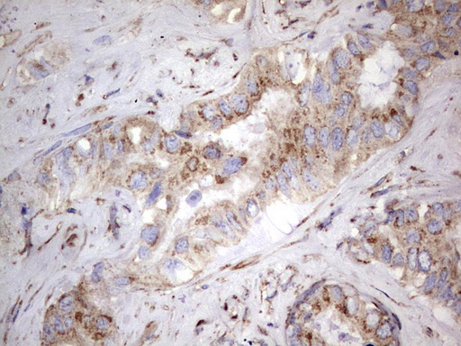m09144 anti nrbf2 mouse monoclonal antibody clone id oti1a2 ihc testing 20