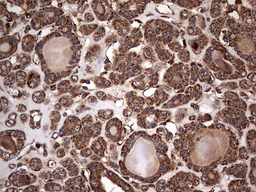m09144 anti nrbf2 mouse monoclonal antibody clone id oti1a2 ihc testing 7